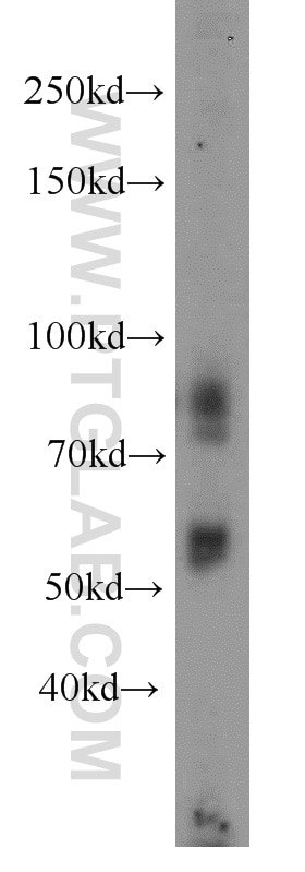 Western Blot (WB) analysis of A431 cells using Sam50 Polyclonal antibody (20824-1-AP)