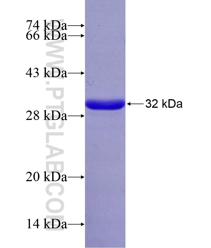 SAMM50 fusion protein Ag29147 SDS-PAGE