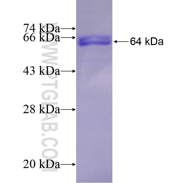 SAMM50 fusion protein Ag14799 SDS-PAGE