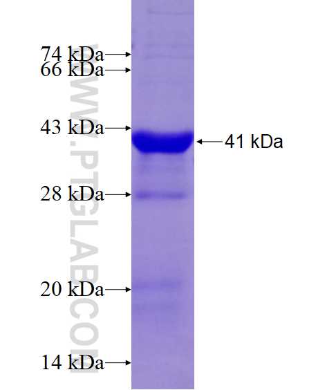 SAMM50 fusion protein Ag15155 SDS-PAGE