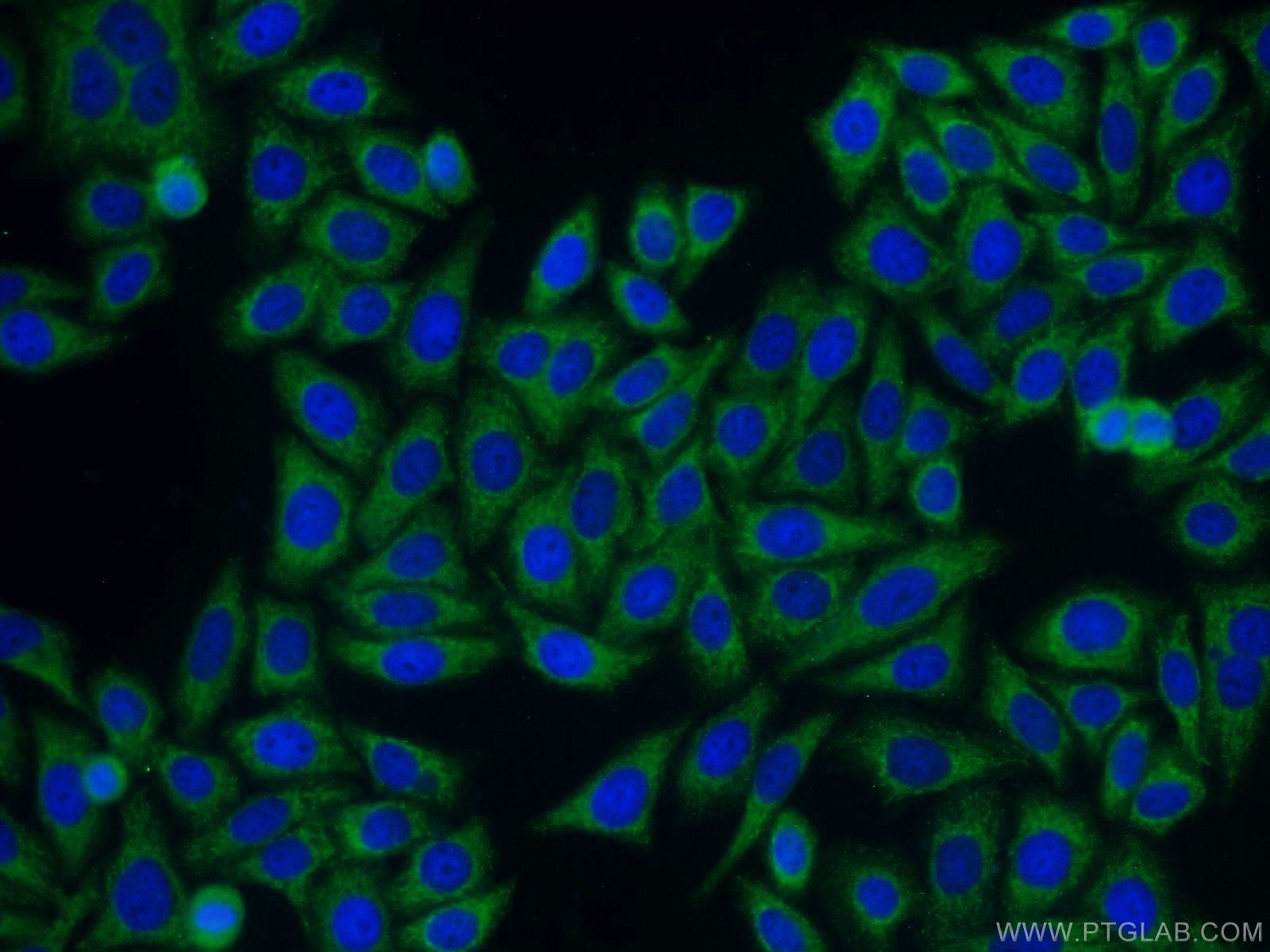 Immunofluorescence (IF) / fluorescent staining of HepG2 cells using SAMSN1 Polyclonal antibody (13063-1-AP)