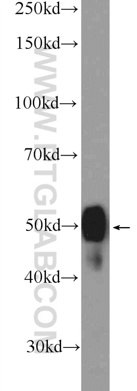Western Blot (WB) analysis of K-562 cells using SAMSN1 Polyclonal antibody (13063-1-AP)