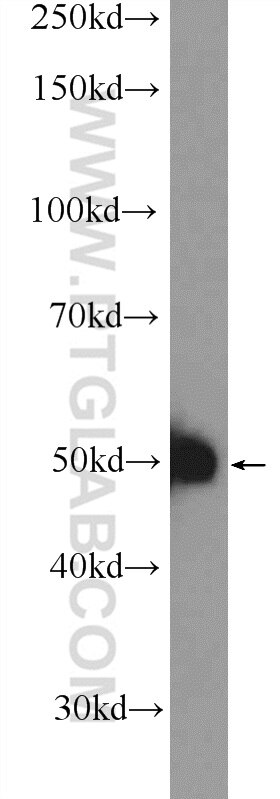 Western Blot (WB) analysis of K-562 cells using SAMSN1 Polyclonal antibody (13063-1-AP)