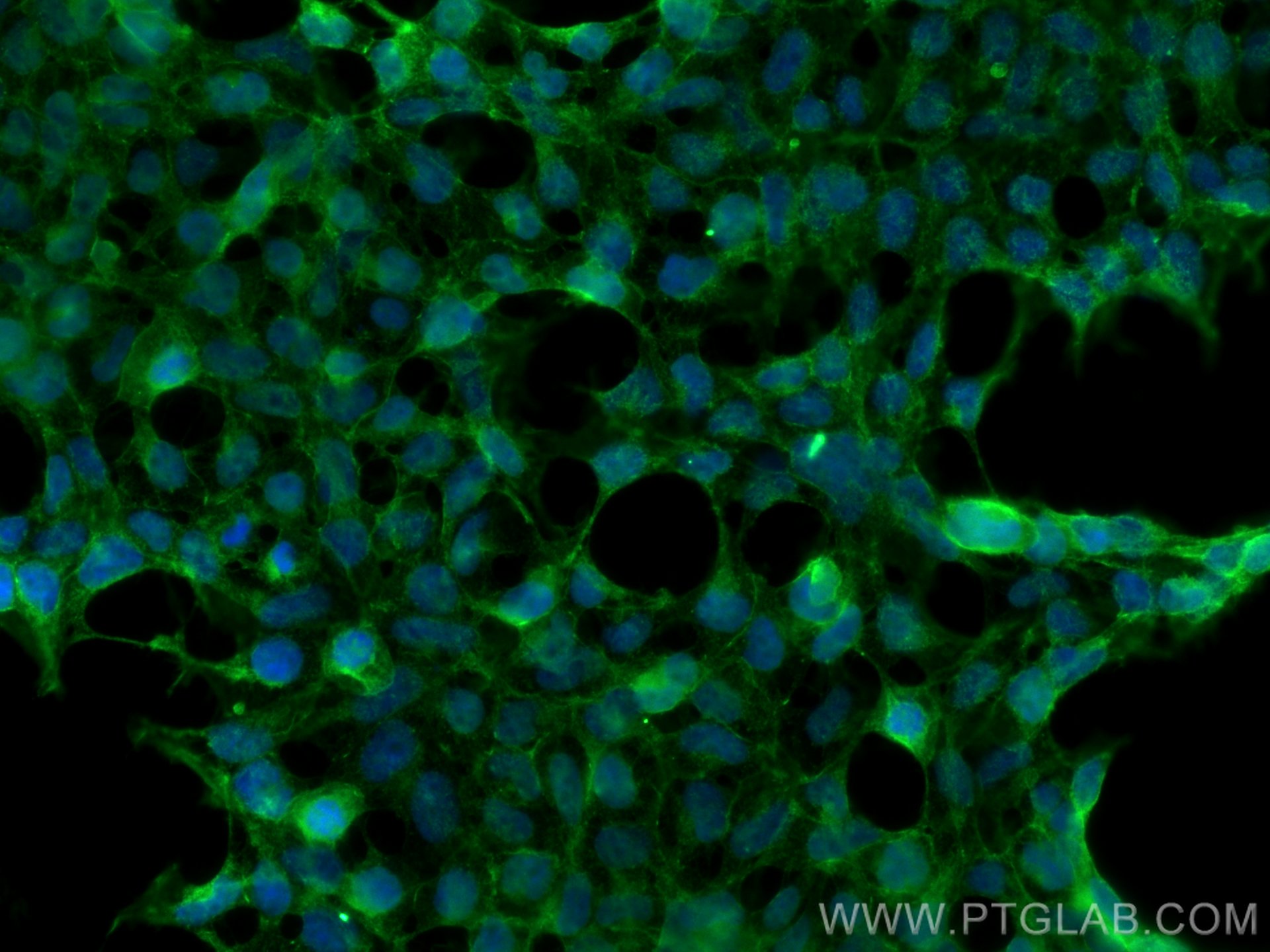 Immunofluorescence (IF) / fluorescent staining of HEK-293 cells using SAP 97 Polyclonal antibody (29292-1-AP)