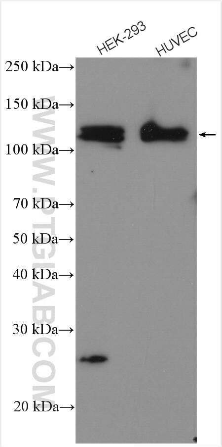 Western Blot (WB) analysis of various lysates using SAP 97 Polyclonal antibody (29292-1-AP)