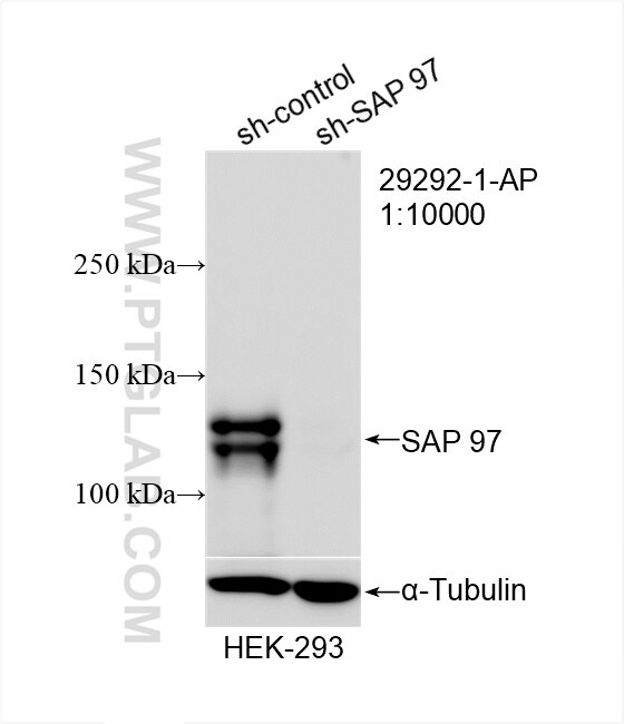 Western Blot (WB) analysis of HEK-293 cells using SAP 97 Polyclonal antibody (29292-1-AP)