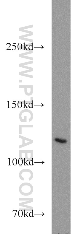 Western Blot (WB) analysis of mouse lung tissue using SAP 97 Polyclonal antibody (55085-1-AP)