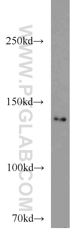 Western Blot (WB) analysis of HeLa cells using SAP 97 Polyclonal antibody (55085-1-AP)
