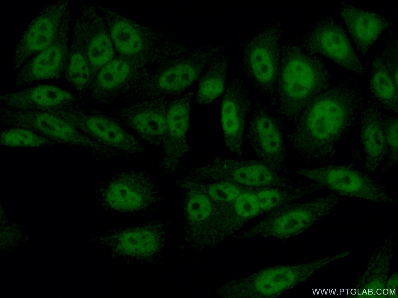 Immunofluorescence (IF) / fluorescent staining of HepG2 cells using SAP130 Polyclonal antibody (12130-1-AP)