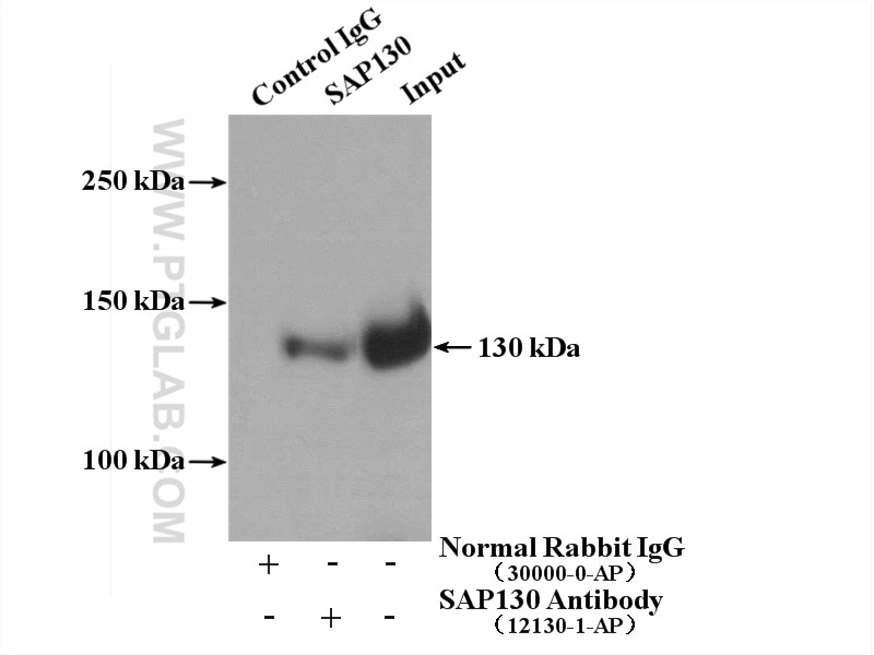 Immunoprecipitation (IP) experiment of HepG2 cells using SAP130 Polyclonal antibody (12130-1-AP)