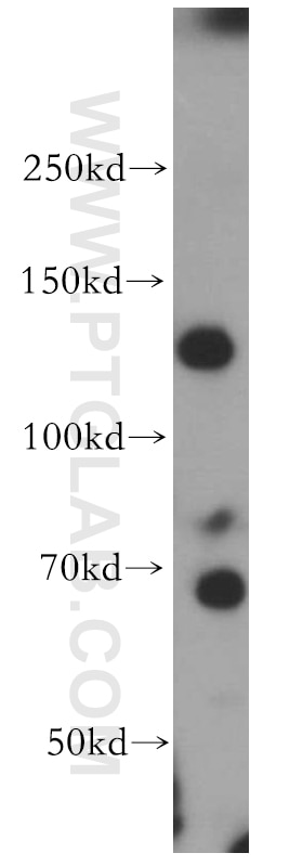 Western Blot (WB) analysis of Jurkat cells using SAP130 Polyclonal antibody (12130-1-AP)