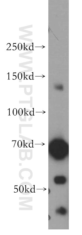 Western Blot (WB) analysis of K-562 cells using SAP130 Polyclonal antibody (12130-1-AP)