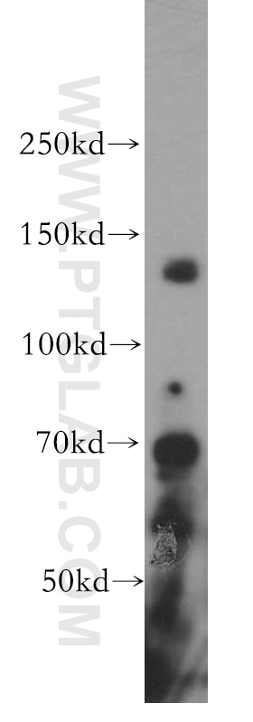 Western Blot (WB) analysis of HeLa cells using SAP130 Polyclonal antibody (12130-1-AP)