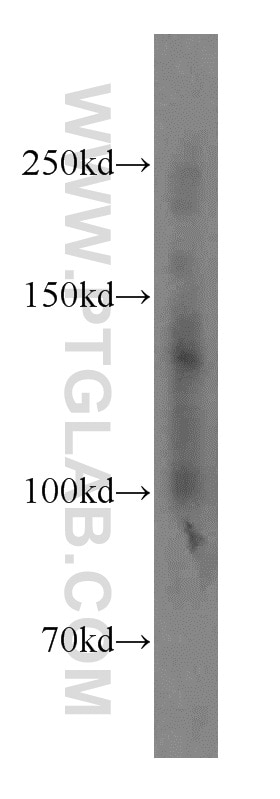 WB analysis of HepG2 using 12130-1-AP