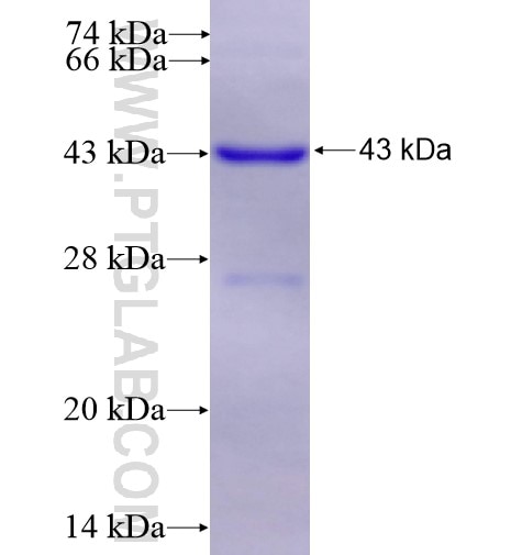 SAP130 fusion protein Ag15274 SDS-PAGE SAP130 fusion protein Ag15274 SDS-PAGE