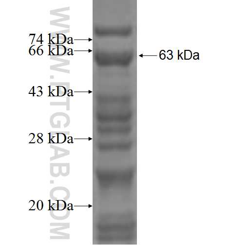 SAP130 fusion protein Ag2774 SDS-PAGE