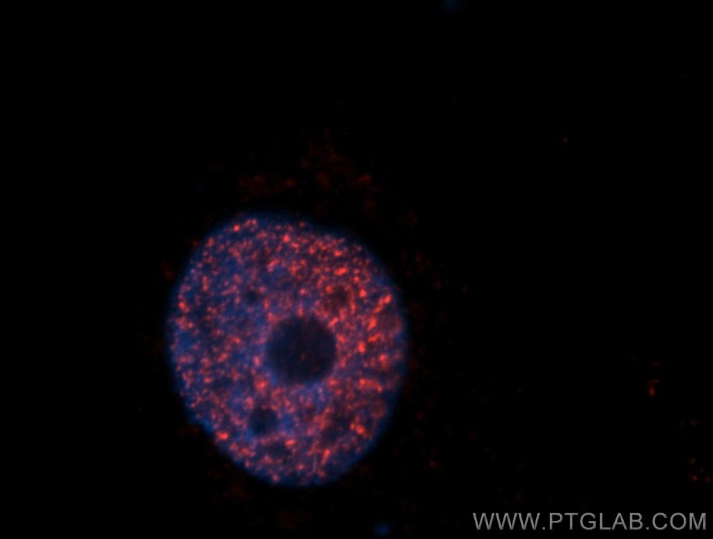 Immunofluorescence (IF) / fluorescent staining of HeLa cells using SAP18 Polyclonal antibody (13841-1-AP)