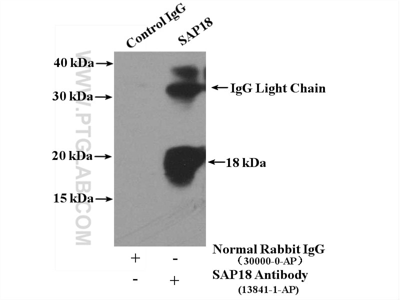 Immunoprecipitation (IP) experiment of K-562 cells using SAP18 Polyclonal antibody (13841-1-AP)