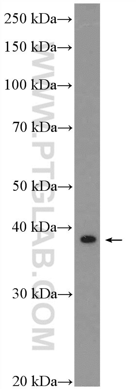 Western Blot (WB) analysis of mouse spleen tissue using SAP30BP Polyclonal antibody (20943-1-AP)