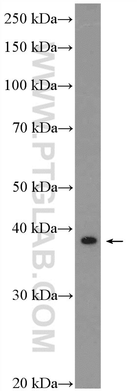 Western Blot (WB) analysis of mouse spleen tissue using SAP30BP Polyclonal antibody (20943-1-AP)
