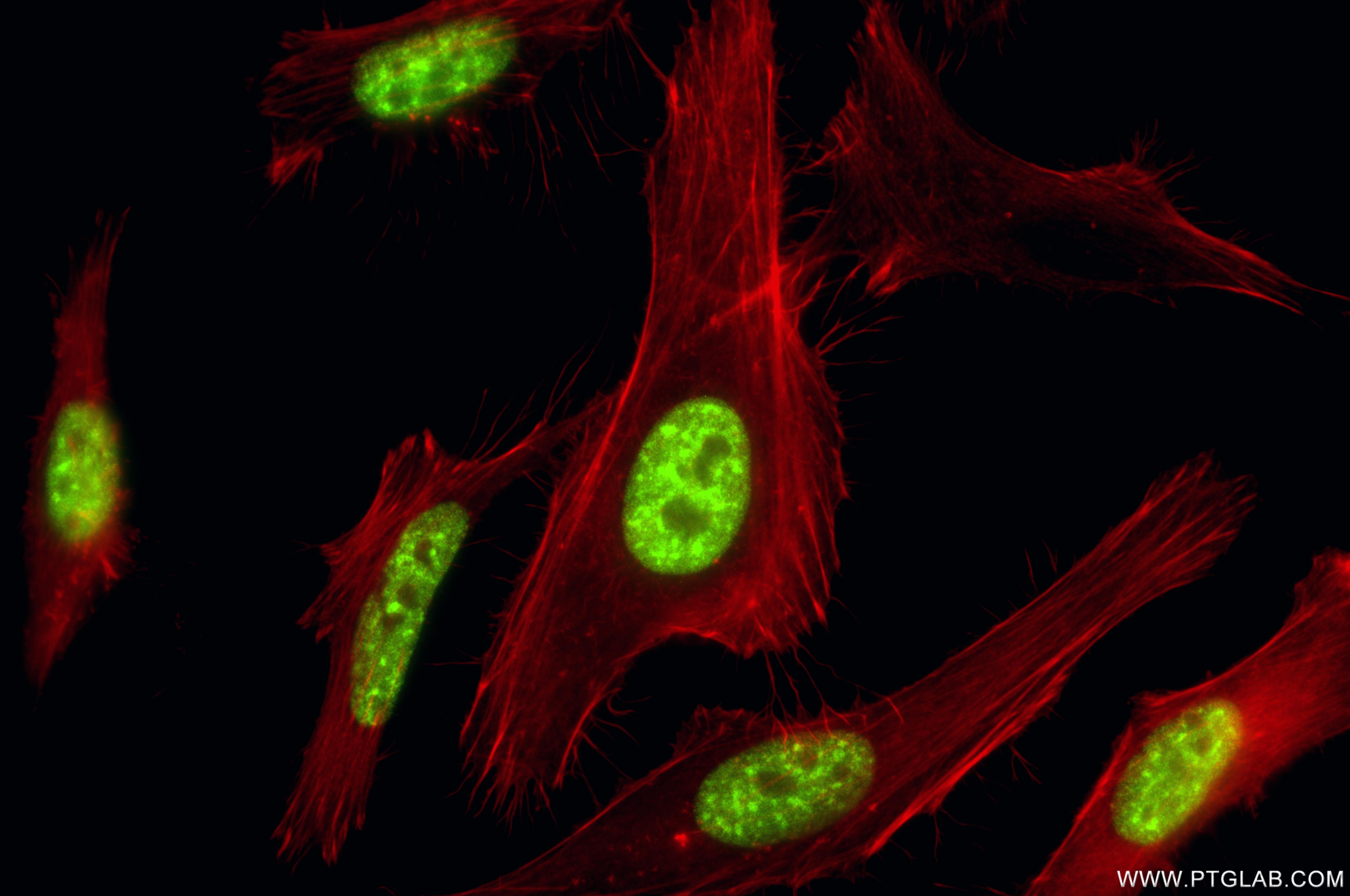 Immunofluorescence (IF) / fluorescent staining of HeLa cells using SAP30BP Recombinant monoclonal antibody (87054-1-RR)