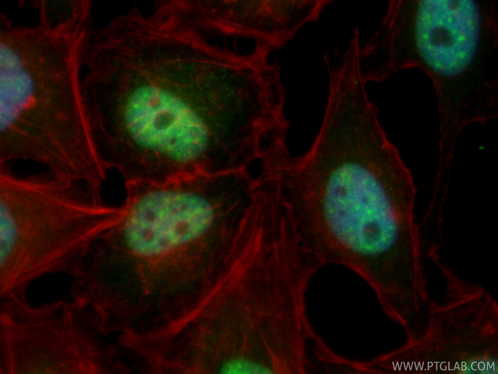 IF Staining of HeLa using CL488-87054 Immunofluorescence (IF) / fluorescent staining of HeLa cells using CoraLite® Plus 488-conjugated SAP30BP Recombinant (CL488-87054)