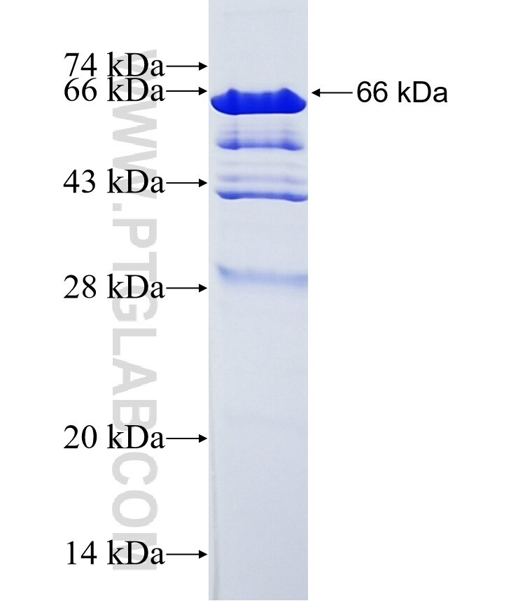 SAP30BP fusion protein Ag15051 SDS-PAGE