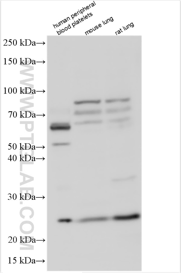 Western Blot (WB) analysis of various lysates using SAP30L Polyclonal antibody (16056-1-AP)