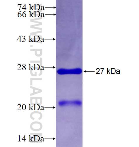SAP30L fusion protein Ag9634 SDS-PAGE SAP30L fusion protein Ag9634 SDS-PAGE