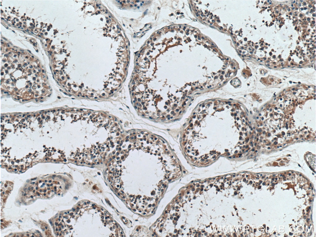 Immunohistochemistry (IHC) staining of human testis tissue using SAPS1 Polyclonal antibody (17819-1-AP)