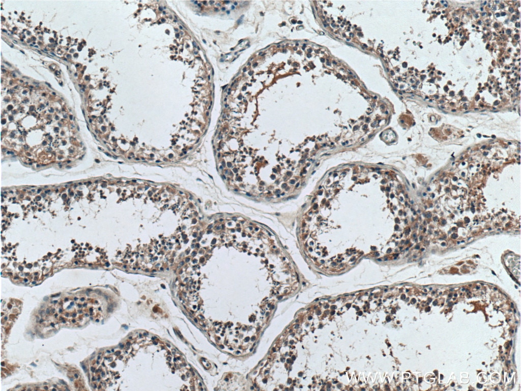 IHC staining of human testis using 17819-1-AP