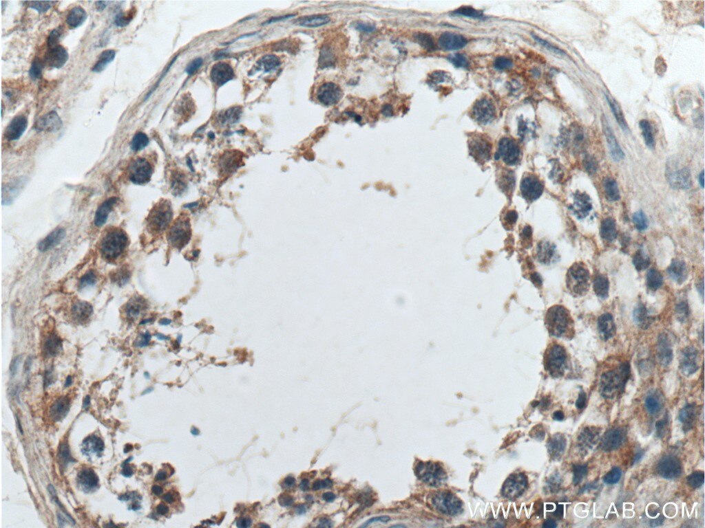 Immunohistochemistry (IHC) staining of human testis tissue using SAPS1 Polyclonal antibody (17819-1-AP)