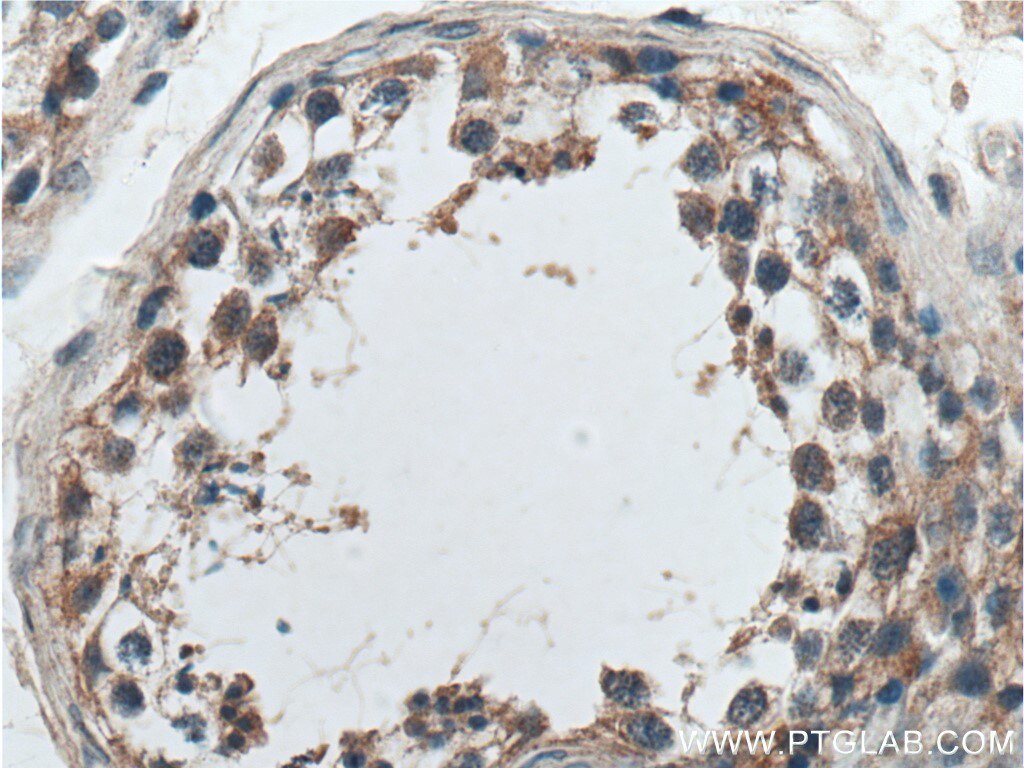 IHC staining of human testis using 17819-1-AP