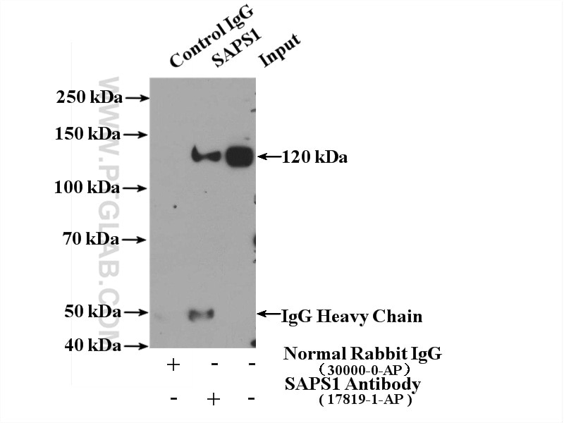 Immunoprecipitation (IP) experiment of HeLa cells using SAPS1 Polyclonal antibody (17819-1-AP)
