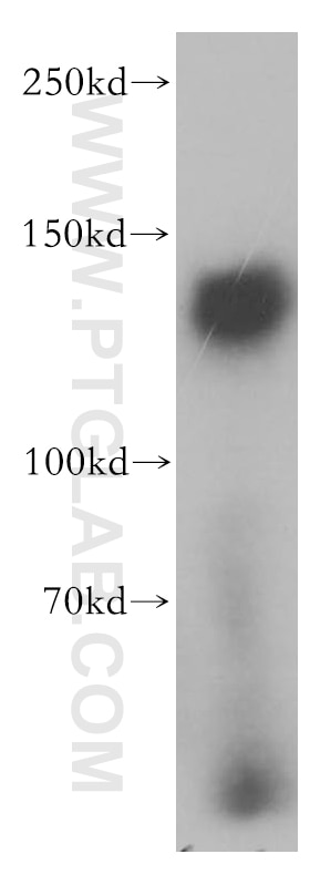 Western Blot (WB) analysis of HEK-293 cells using SAPS1 Polyclonal antibody (17819-1-AP)