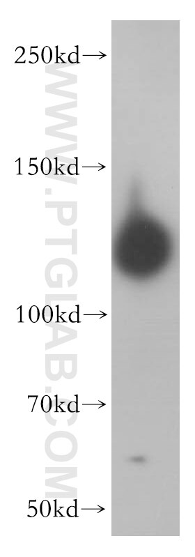 Western Blot (WB) analysis of mouse testis tissue using SAPS1 Polyclonal antibody (17819-1-AP)