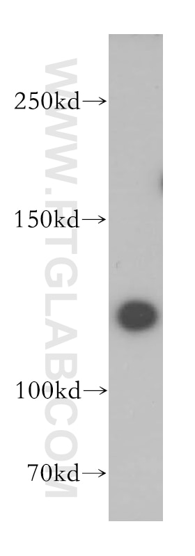 Western Blot (WB) analysis of HeLa cells using SAPS1 Polyclonal antibody (17819-1-AP)