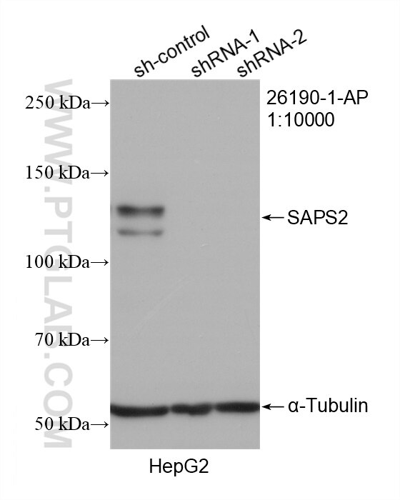 Western Blot (WB) analysis of HepG2 cells using SAPS2 Polyclonal antibody (26190-1-AP)