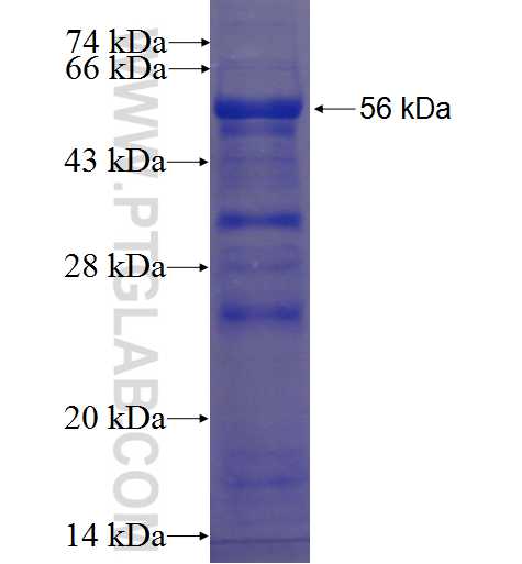 SAPS2 fusion protein Ag23458 SDS-PAGE