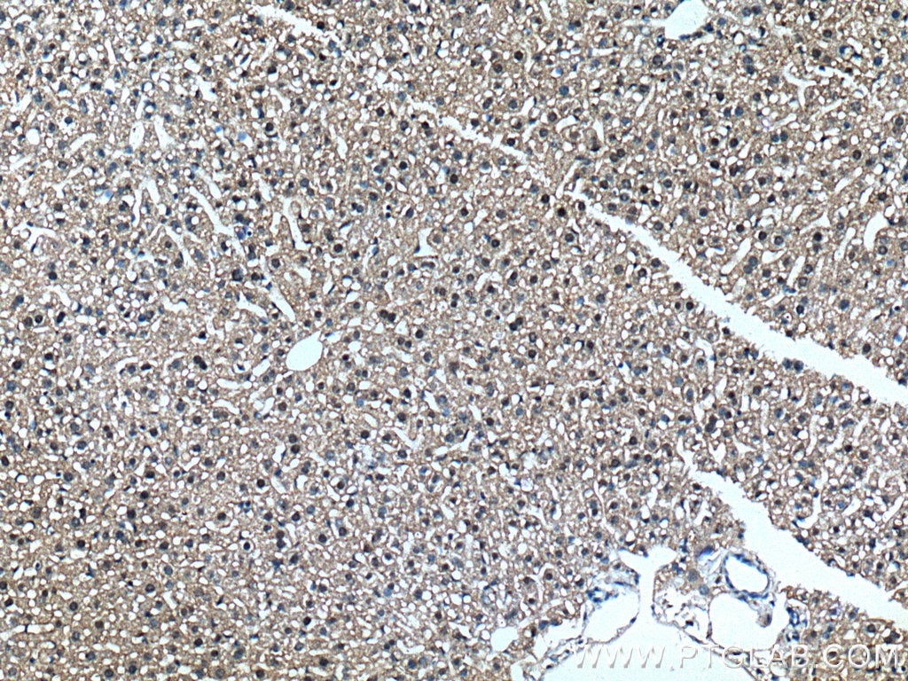 Immunohistochemistry (IHC) staining of mouse liver tissue using SAPS3 Polyclonal antibody (16944-1-AP)