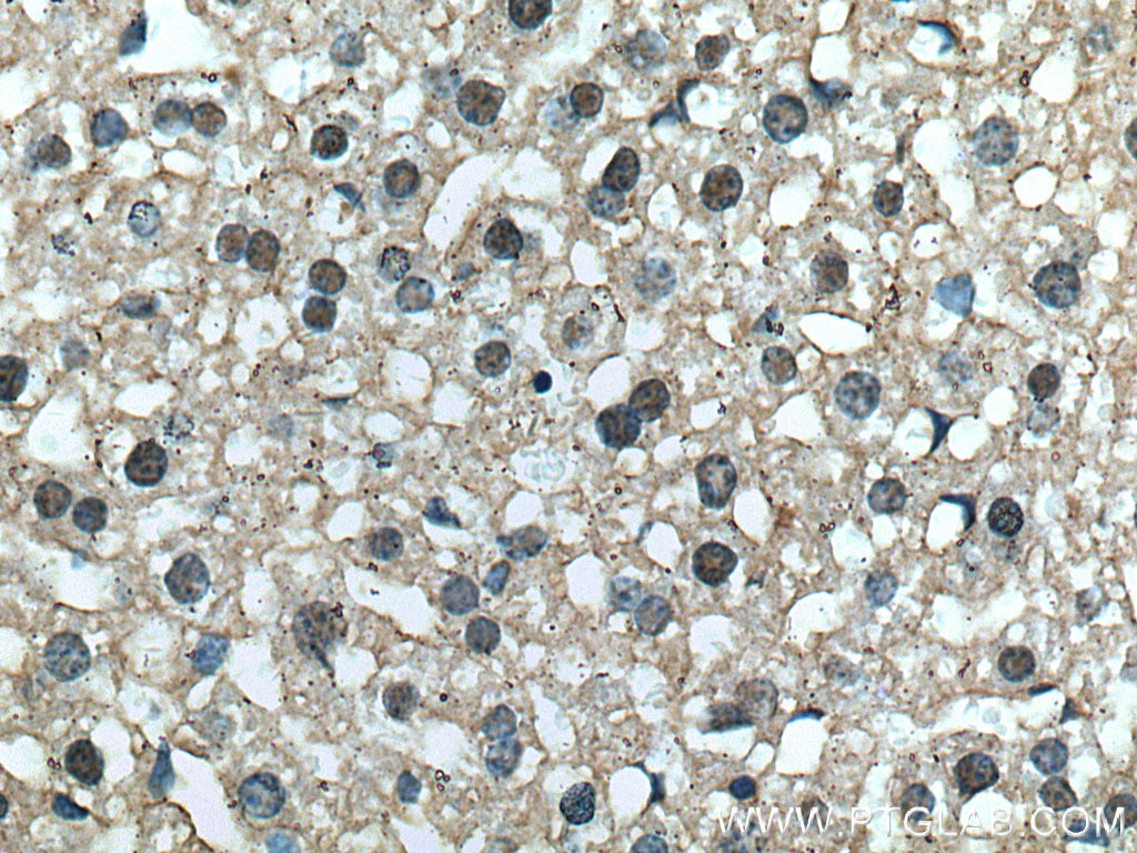 IHC staining of mouse liver using 16944-1-AP