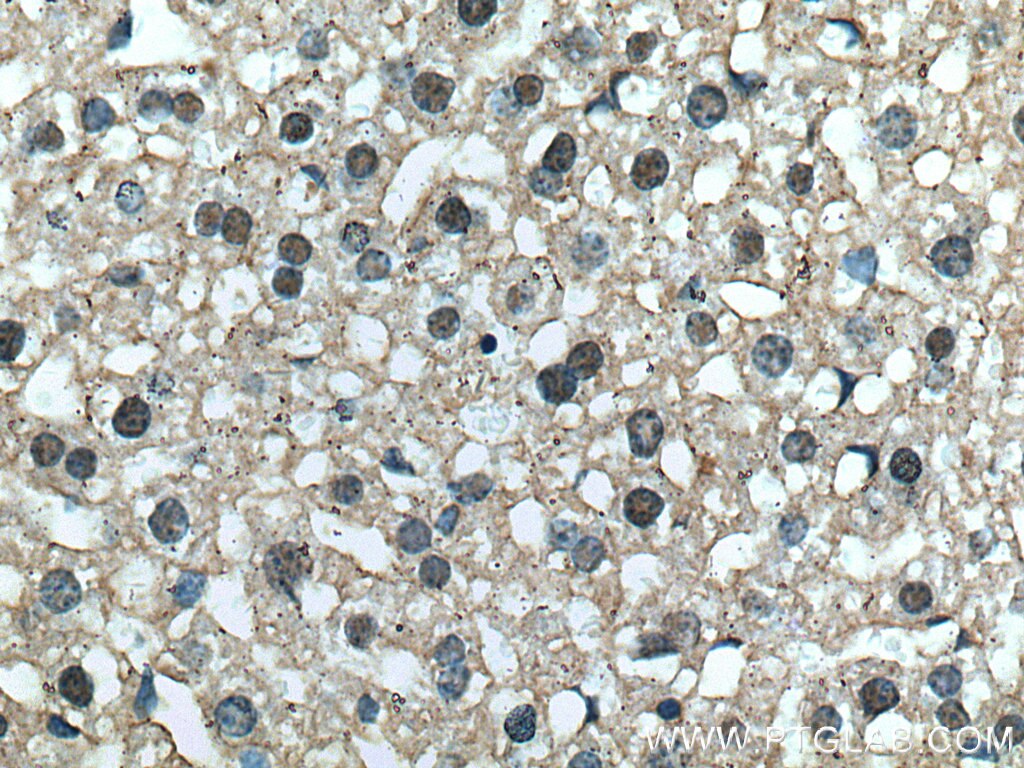 Immunohistochemistry (IHC) staining of mouse liver tissue using SAPS3 Polyclonal antibody (16944-1-AP)