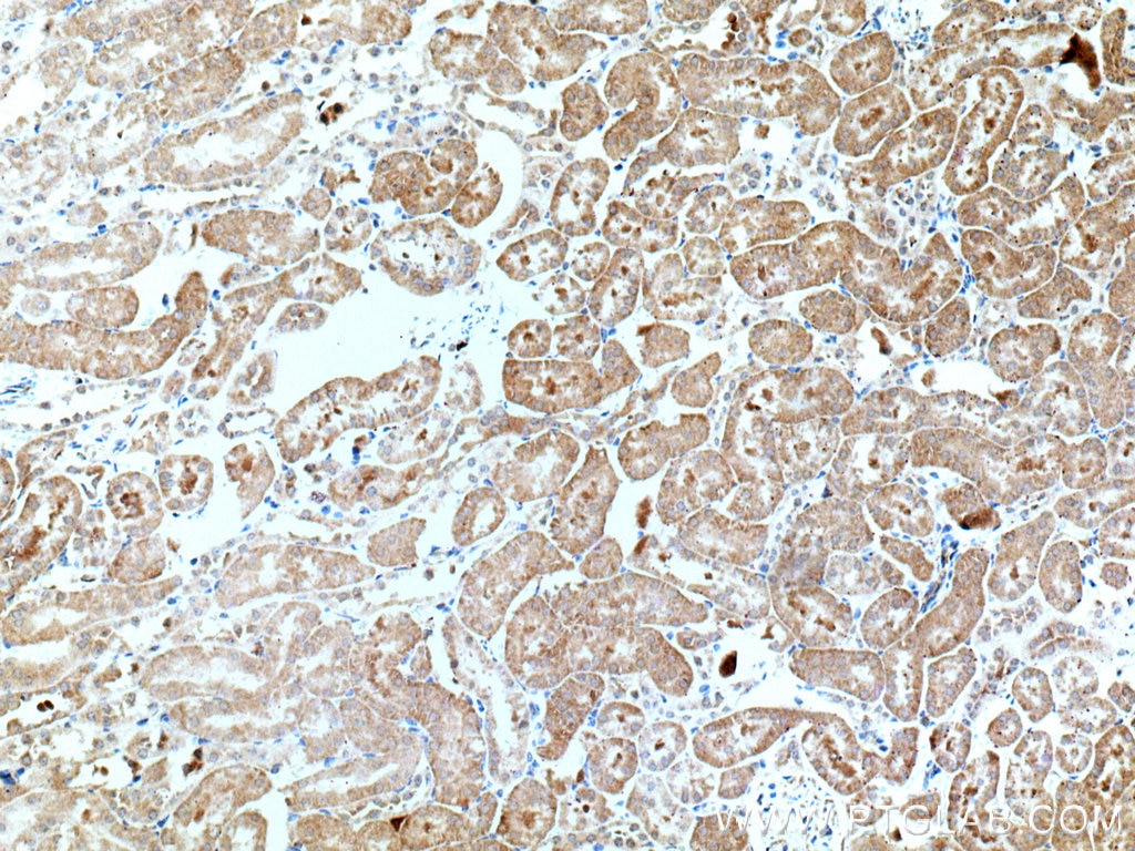 Immunohistochemistry (IHC) staining of mouse kidney tissue using SAPS3 Polyclonal antibody (16944-1-AP)