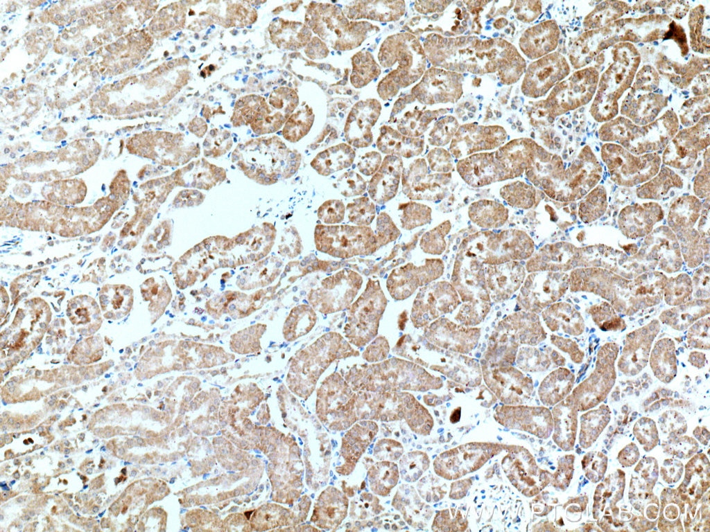 Immunohistochemistry (IHC) staining of mouse kidney tissue using SAPS3 Polyclonal antibody (16944-1-AP)