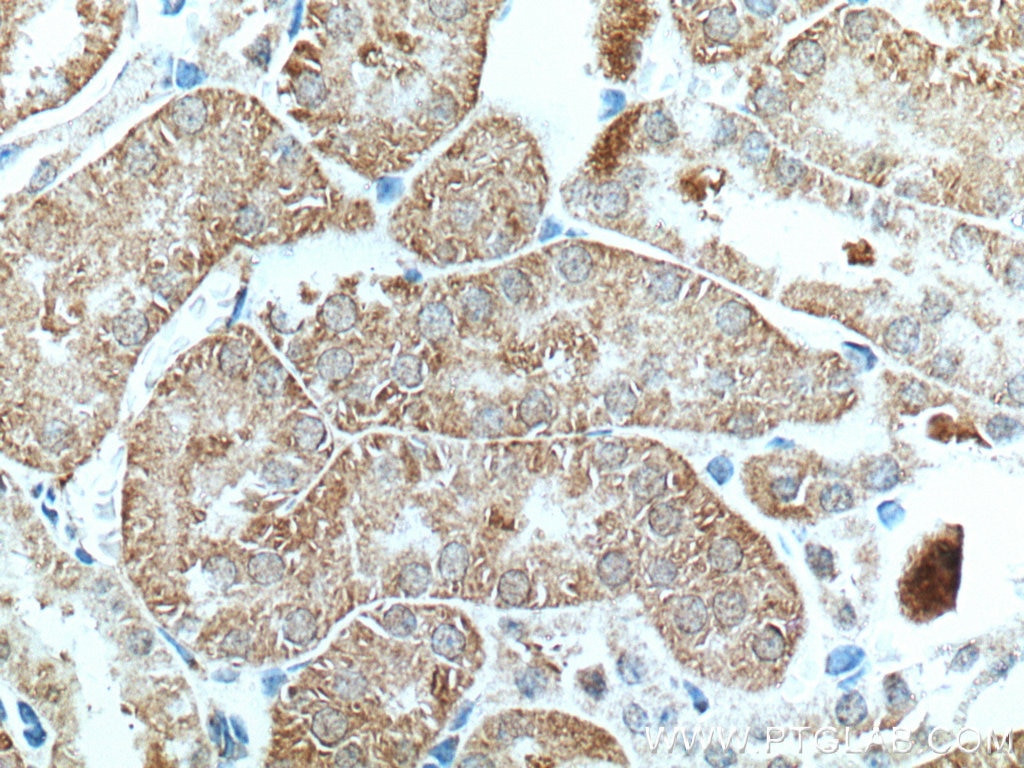 Immunohistochemistry (IHC) staining of mouse kidney tissue using SAPS3 Polyclonal antibody (16944-1-AP)