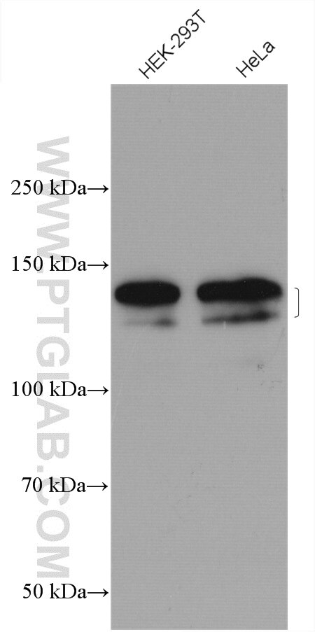 Western Blot (WB) analysis of various lysates using SAPS3 Polyclonal antibody (16944-1-AP)