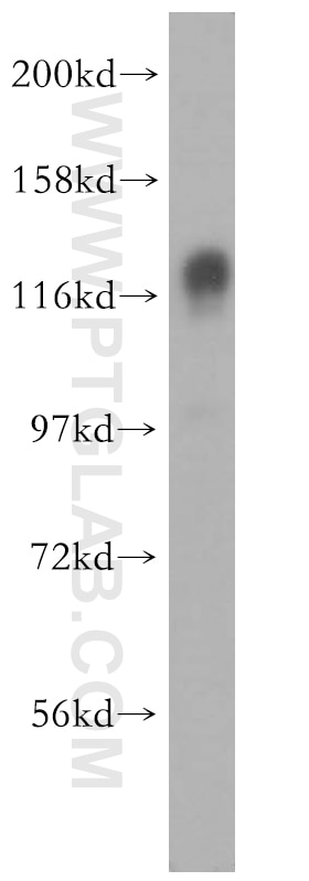 Western Blot (WB) analysis of mouse kidney tissue using SAPS3 Polyclonal antibody (16944-1-AP)