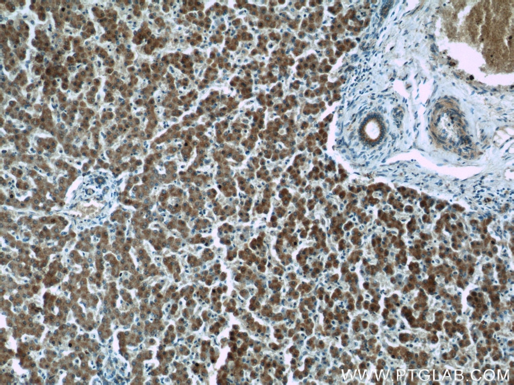 Immunohistochemistry (IHC) staining of human liver tissue using SAR1A Polyclonal antibody (15350-1-AP)