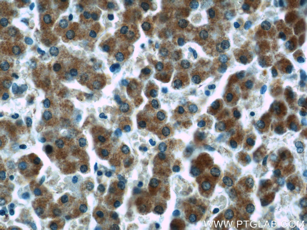 Immunohistochemistry (IHC) staining of human liver tissue using SAR1A Polyclonal antibody (15350-1-AP)