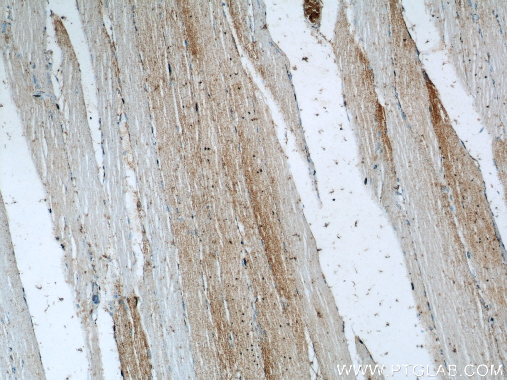 Immunohistochemistry (IHC) staining of human skeletal muscle tissue using SAR1A Polyclonal antibody (15350-1-AP)